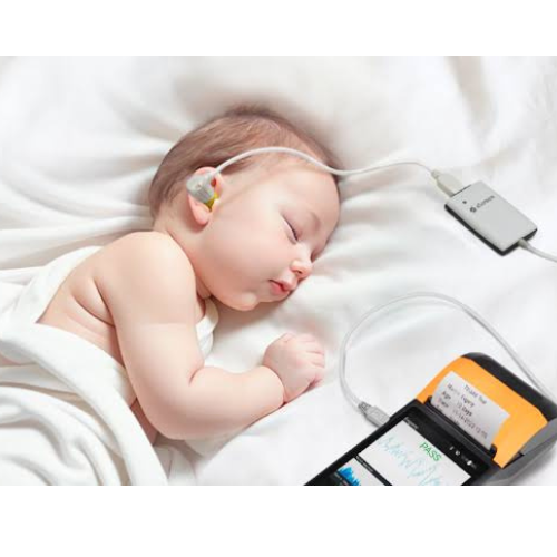 OAE hearing test for newborns at Swar Clinic in Vadodara – early screening for infant hearing health.